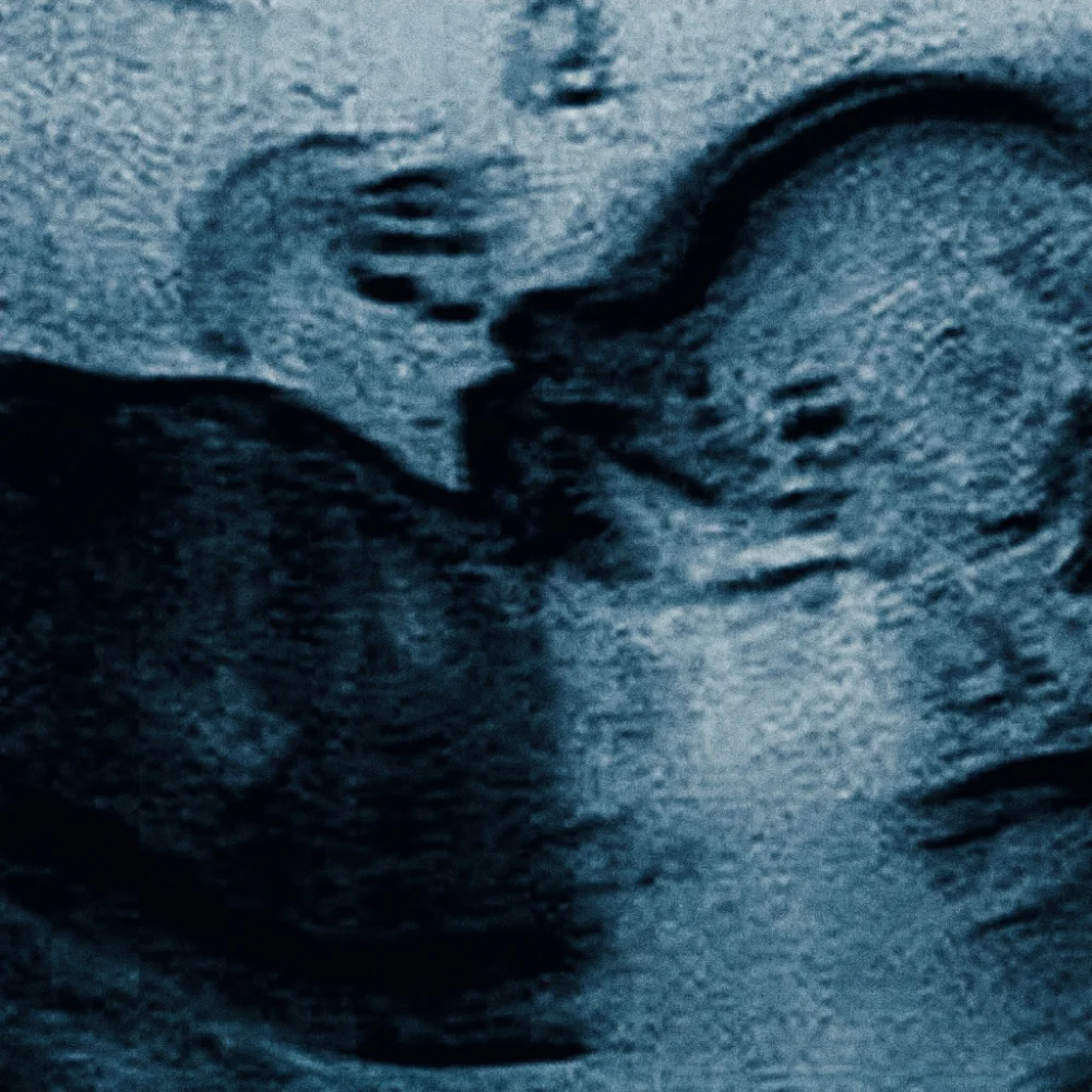 The Passenger EP cover — the first ultrasound photograph of the passenger, by Sophie Kazandjian